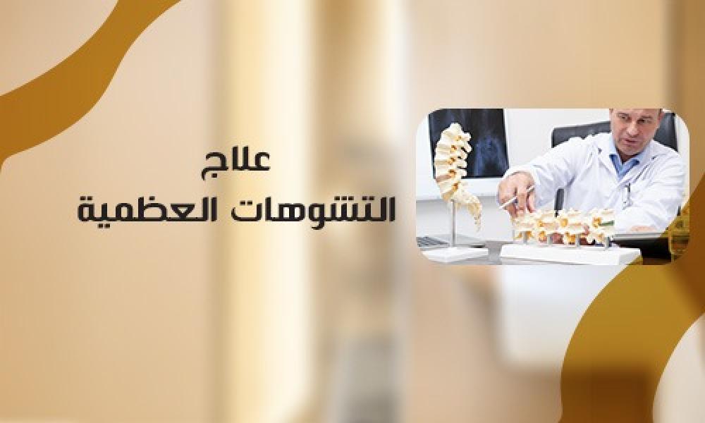 علاج التشوهات العظمية: تصحيح دقيق لاستعادة الوظيفة والمظهر الطبيعي