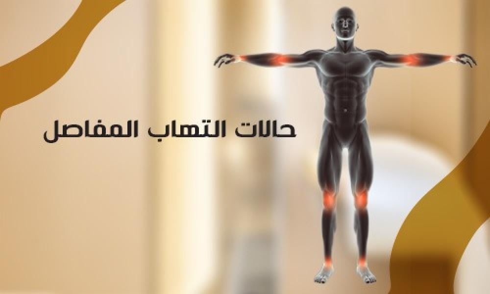حالات التهاب المفاصل: الأسباب والأعراض وطرق العلاج