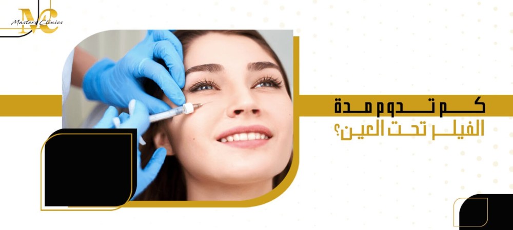 كم تدوم مدة الفيلر تحت العين