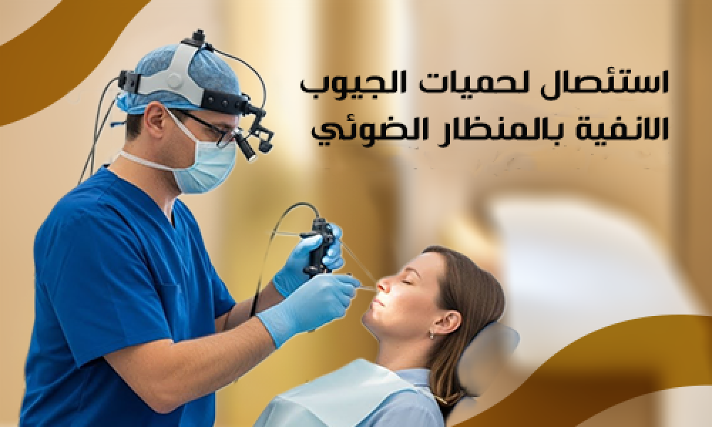 أفضل استئصال لحميات الجيوب الأنفية بالمنظار الضوئي في عيادات ماسترز