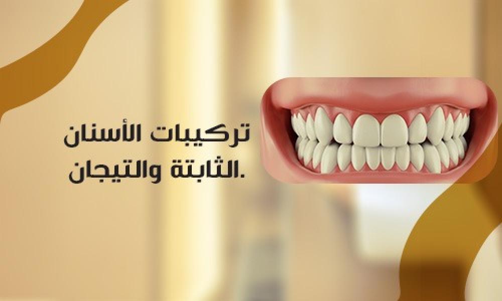 التأثير الوظيفي لتركيبات الأسنان الثابتة والتيجان على صحة الفم بالكامل