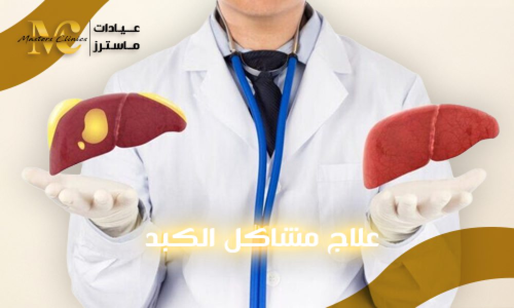 علاج مشاكل الكبد في عيادات ماسترز بأحدث الطرق الطبية