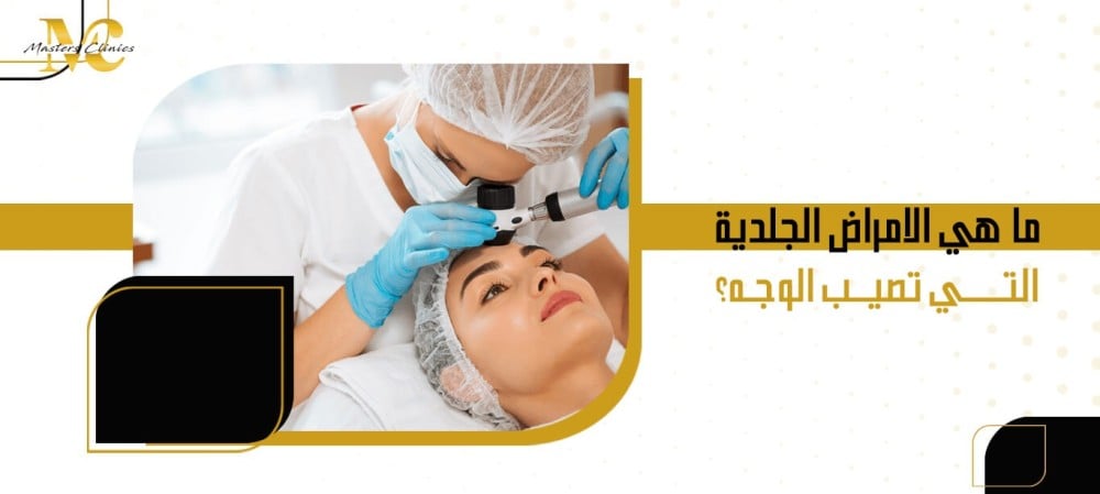 ما هي الامراض الجلدية التي تصيب الوجه