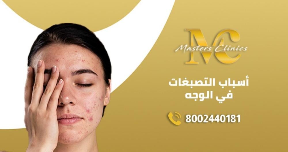 أسباب التصبغات في الوجه وعلاجها بجلسات ليزميد