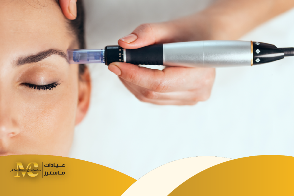 جلسات الديرما بن لنضارة البشرة