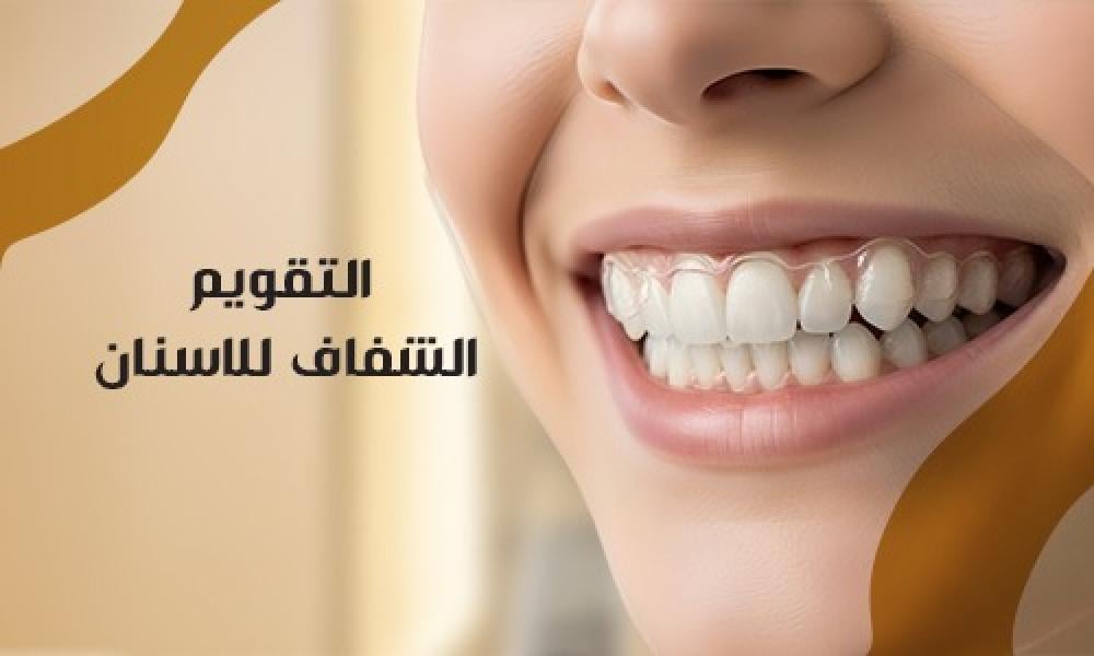 التقويم الشفاف: حل طبي متطور لتصحيح الأسنان دون مظهر معدني