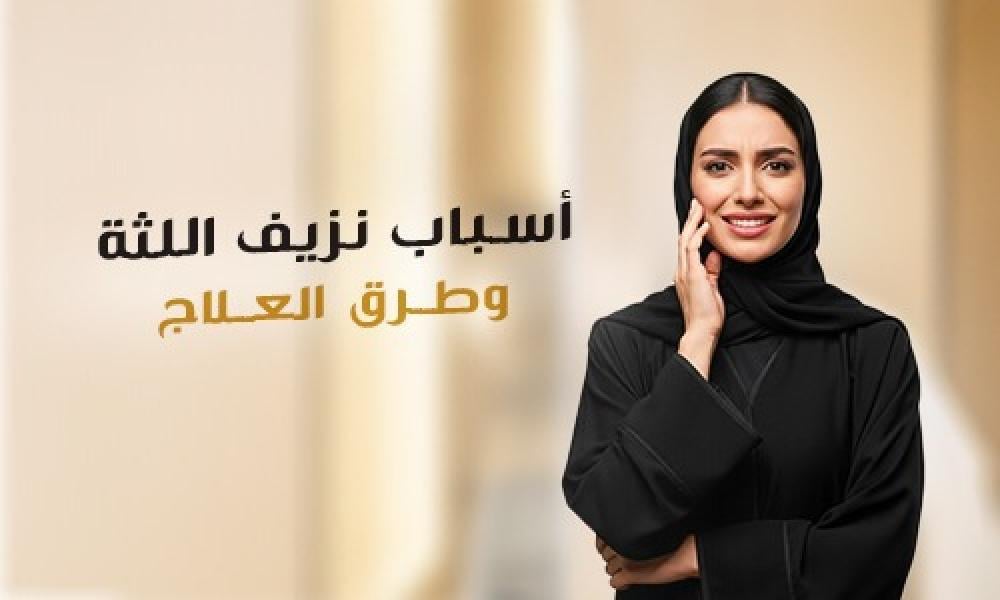 نزيف اللثة: أسبابه وأفضل طرق العلاج