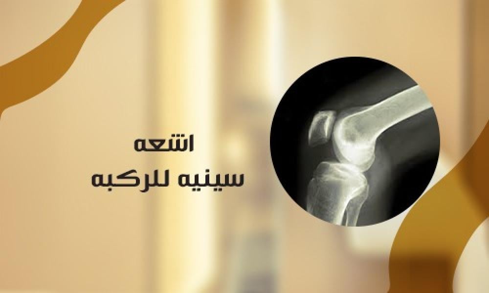 أشعة سينية للركبة لتشخيص آلام الركبة ومشاكل المفاصل في عيادات ماسترز