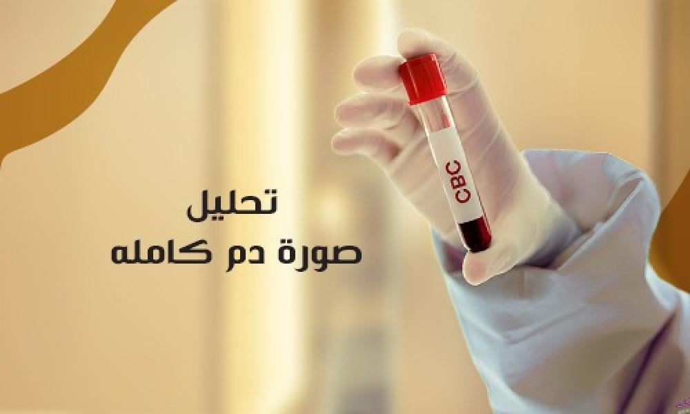 تحليل صورة الدم الكاملة: دليلك لاكتشاف صحتك بدقة