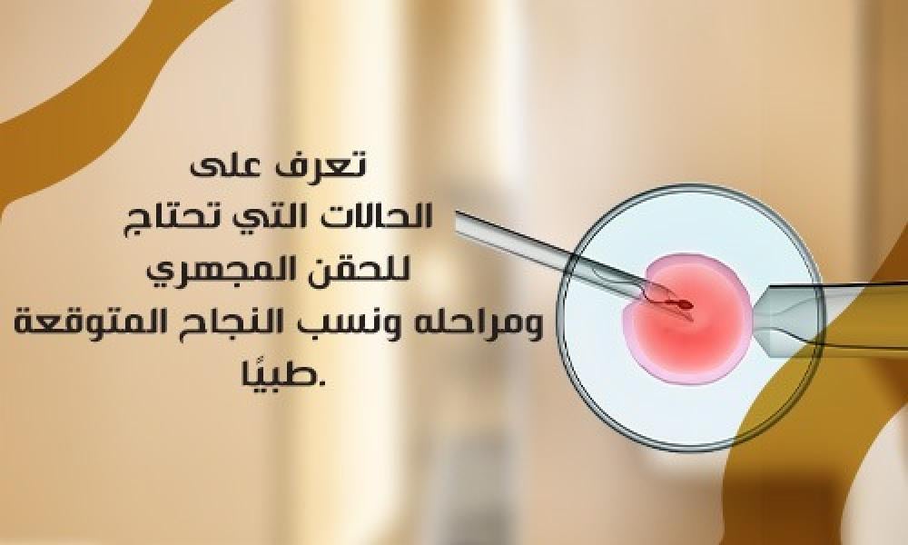 متى يُنصح بالحقن المجهري؟ وما فرص نجاحه؟