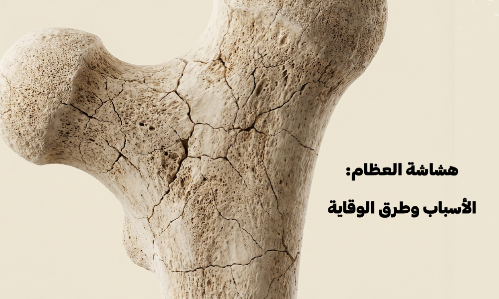 هشاشة العظام: الأسباب وطرق الوقاية – عيادات ماسترز