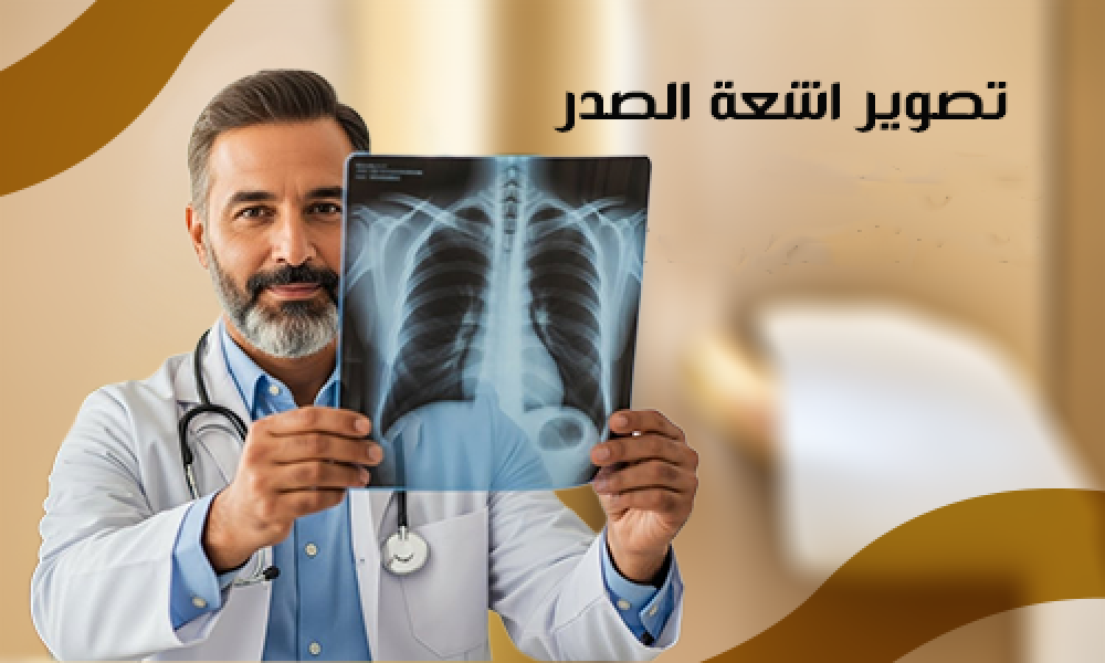 تشخيص أمراض الصدر بالأشعة في عيادات ماسترز: دقة عالية وتصوير متقدم