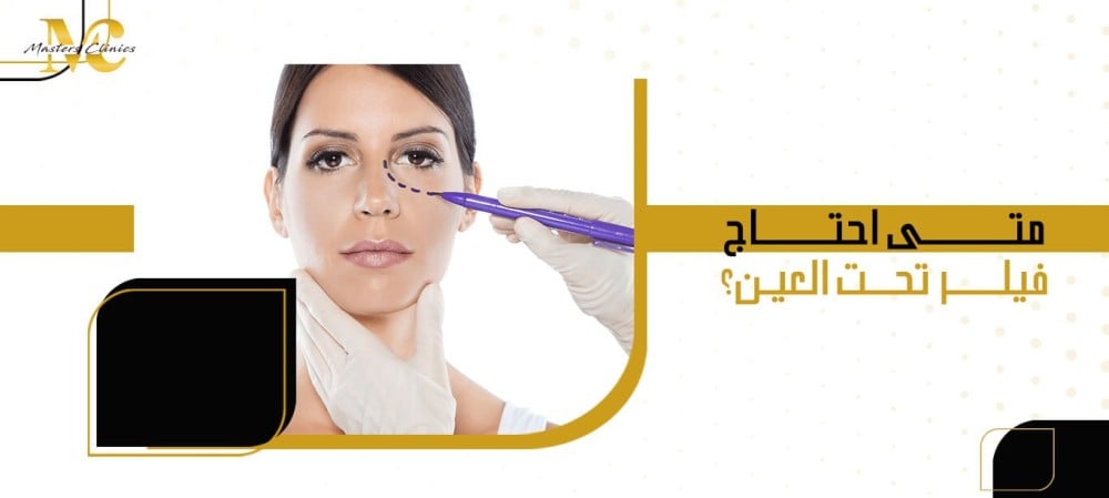متى احتاج فيلر تحت العين