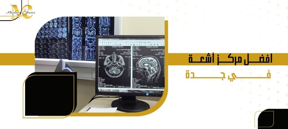 افضل مركز أشعة في جدة