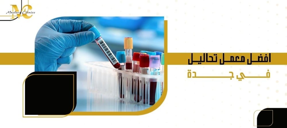 افضل معمل تحاليل في جدة