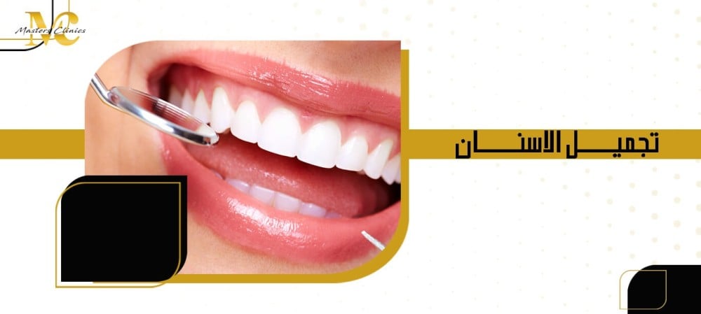 تجميل الاسنان
