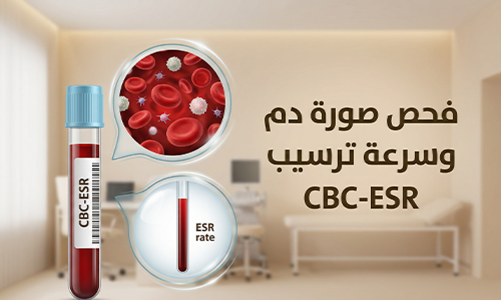 صورة دم واحدة… تكشف كتير