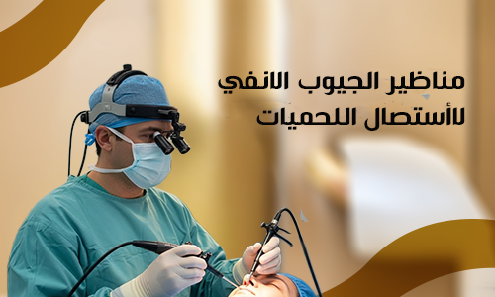مناظير الجيوب الأنفية لاستئصال اللحميات بنتائج سريعة في عيادات ماسترز