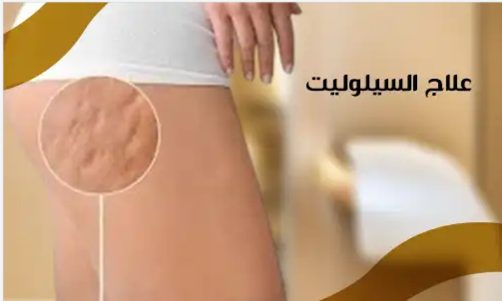 علاج السيلوليت وتحسين ملمس الجلد بنتائج واضحة