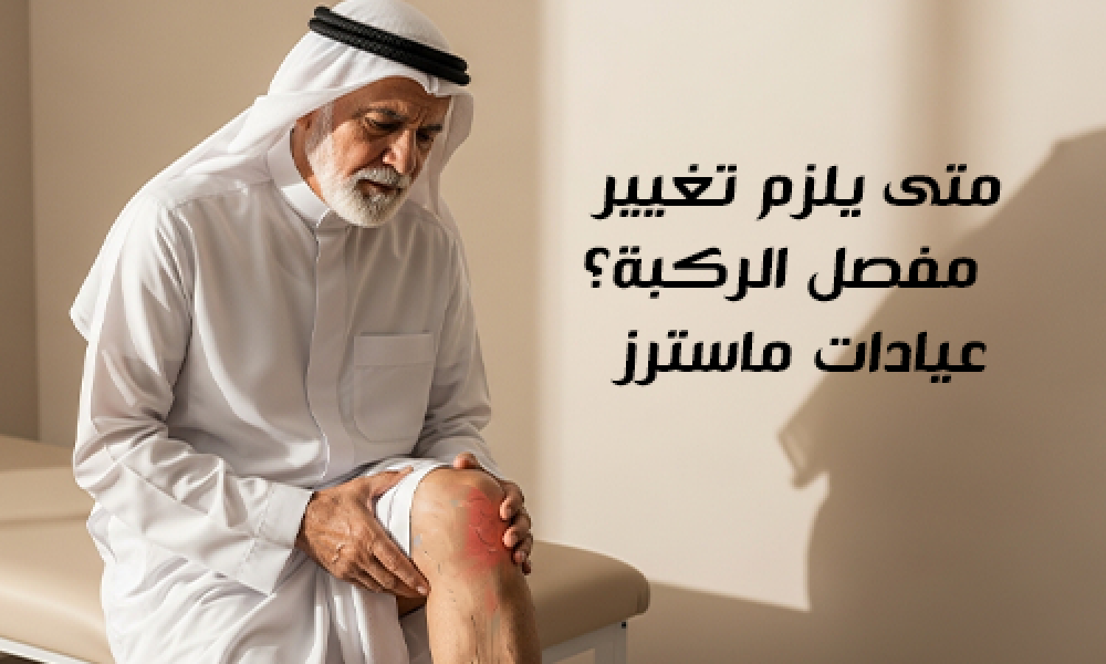 متى يلزم تغيير مفصل الركبة؟ – عيادات ماسترز