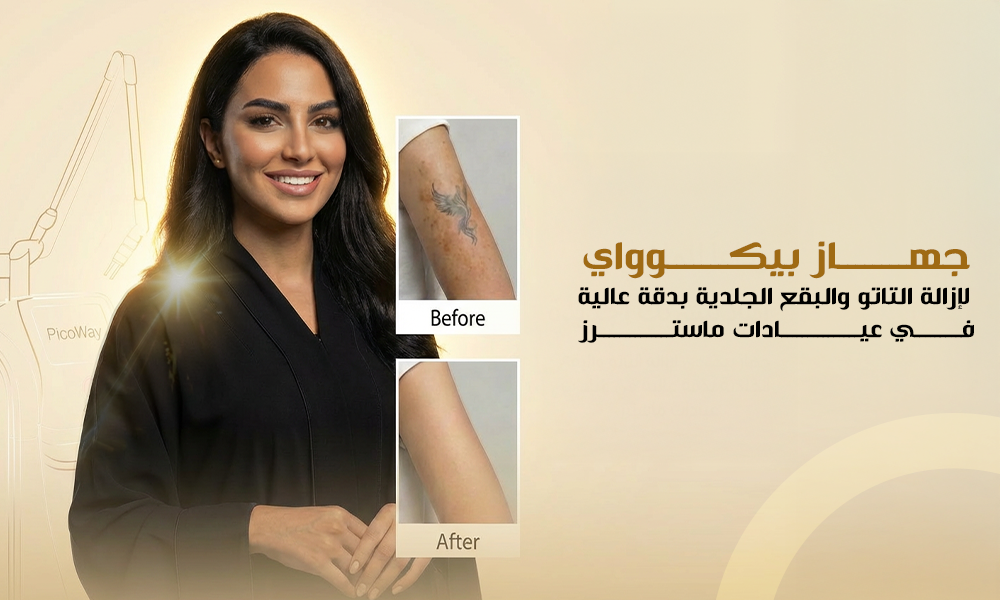 تقنية البيكو واي: تفتيح فعّال وإزالة تاتو بدقّة عالية في ماسترز