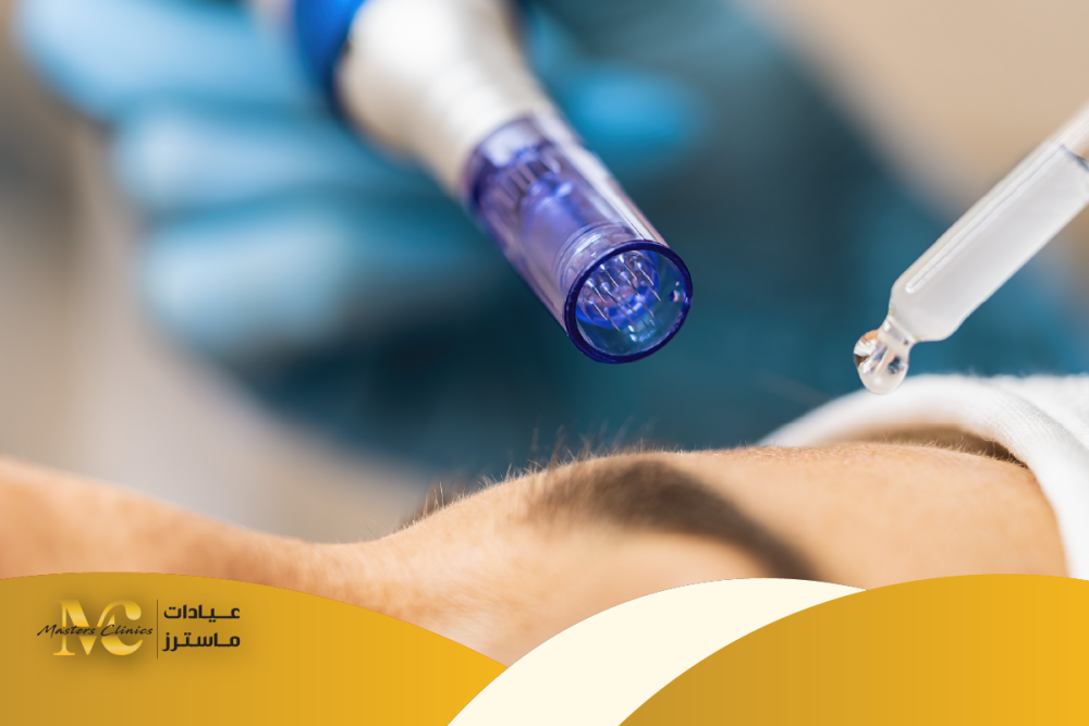 عدد جلسات الديرما للحصول على نتائج