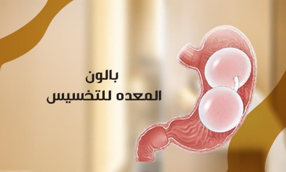 بالون المعدة للتخسيس وفقدان الوزن بأمان في عيادات ماسترز