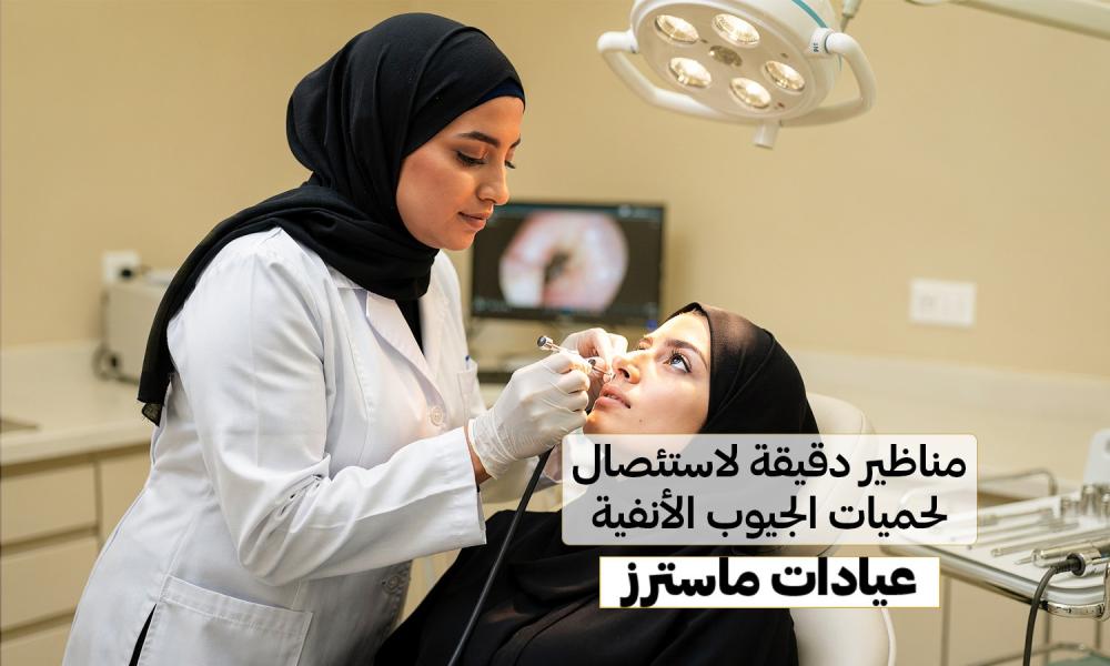 مناظير دقيقة لاستئصال لحميات الجيوب الأنفية – عيادات ماسترز