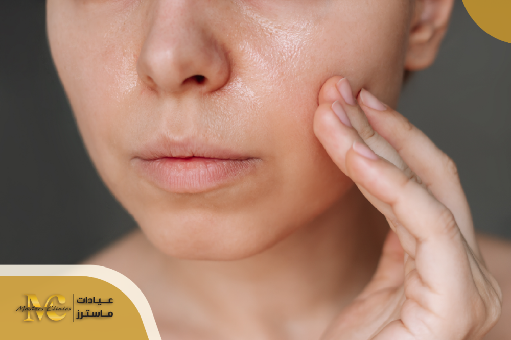 البشرة الدهنية و العناية بها