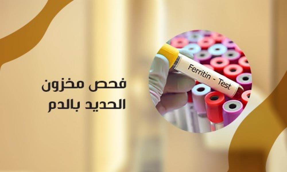 فحص مخزون الحديد بالدم: تقييم شامل لصحة الدم والطاقة