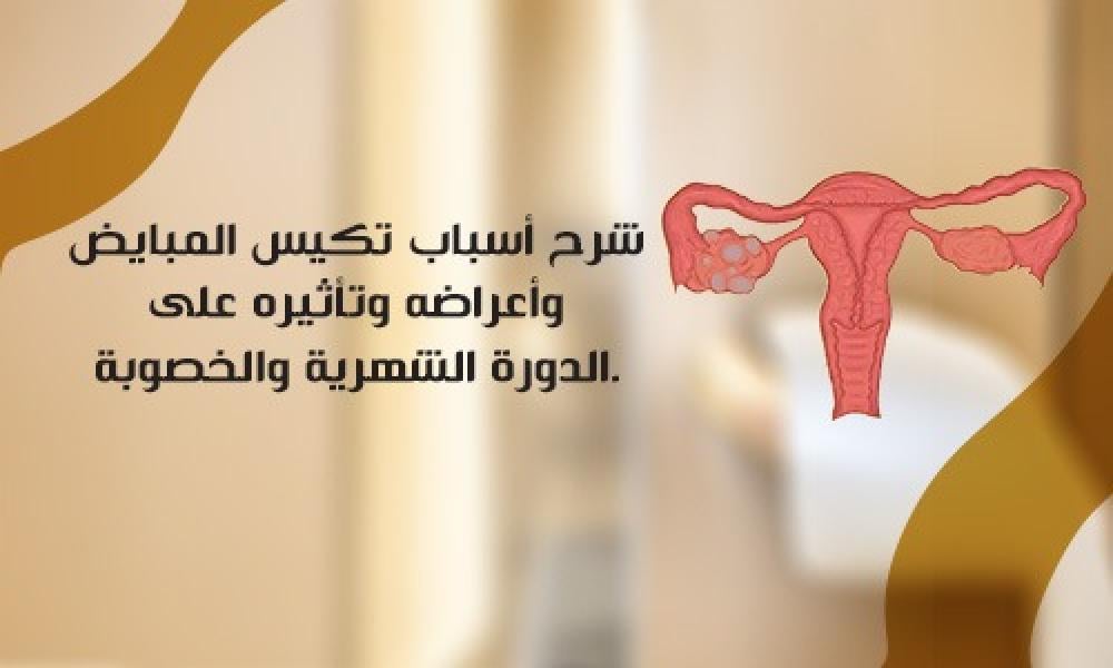 تكيس المبايض: مشكلة شائعة وتأثيرها على الحمل