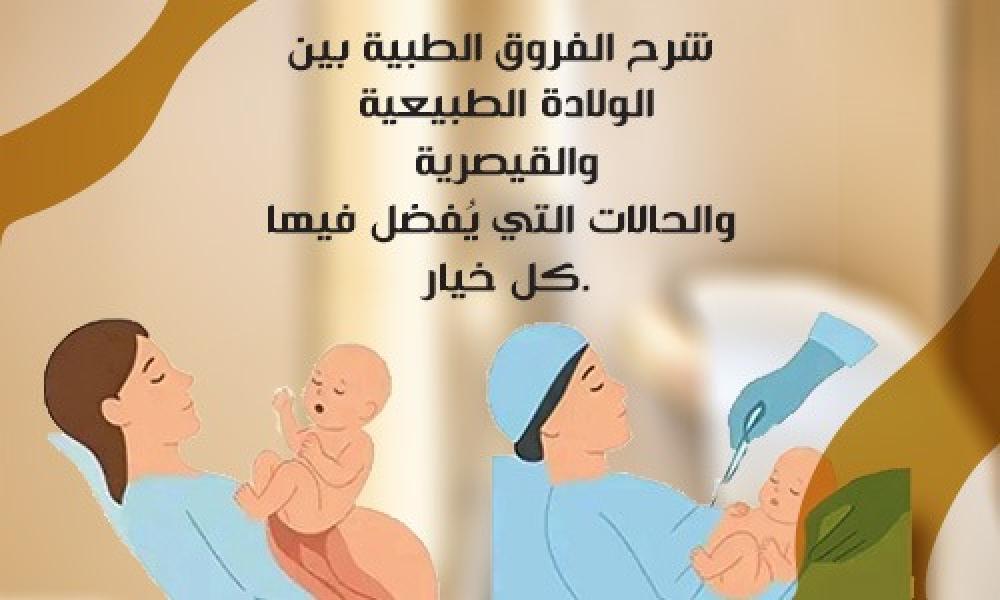 متى تكون الولادة الطبيعية أفضل؟ ومتى نلجأ للقيصرية؟