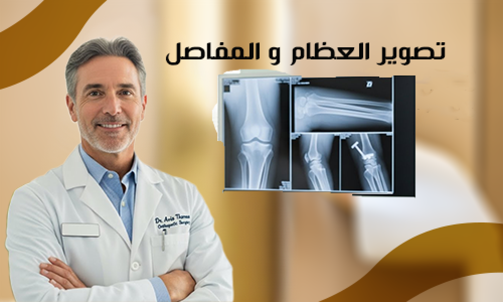 تشخيص كسر العظام والمفاصل بالأشعة في ماسترز – تصوير العظام والمفاصل بدقة