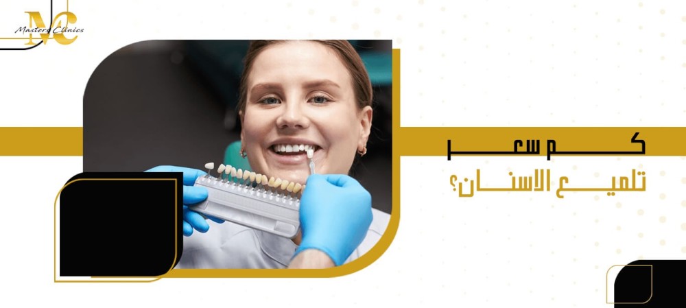 كم سعر تلميع الاسنان