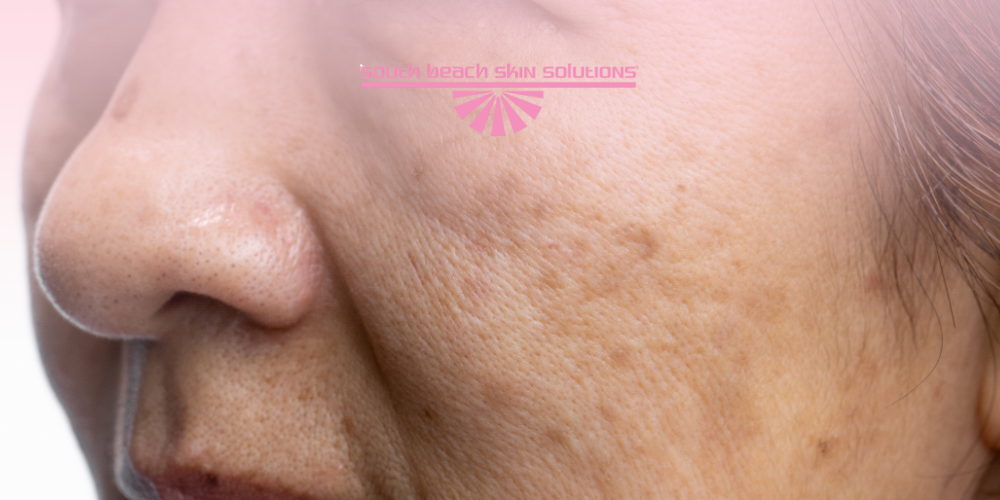 التصبغات الجلدية: الأسباب والعلاج الآمن