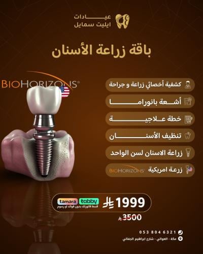 باقة زراعة الأسنان