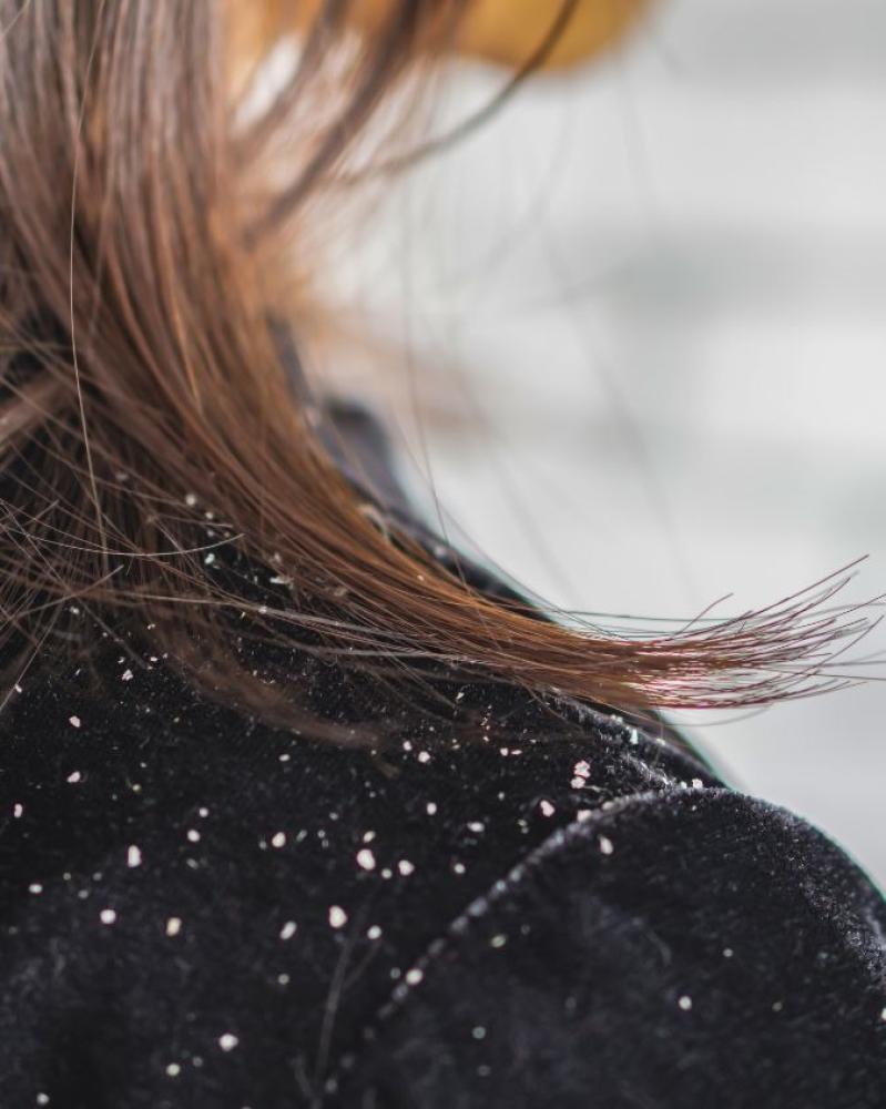 كيف يعالج ZERO.10 قشرة الشعر؟