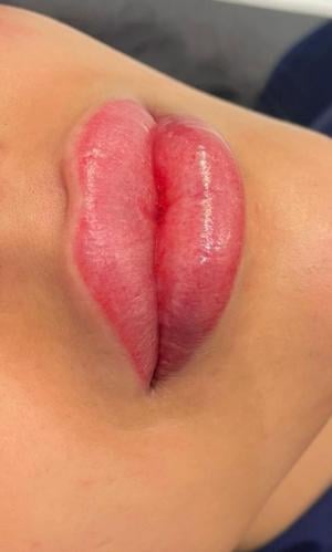 توريد شفايف