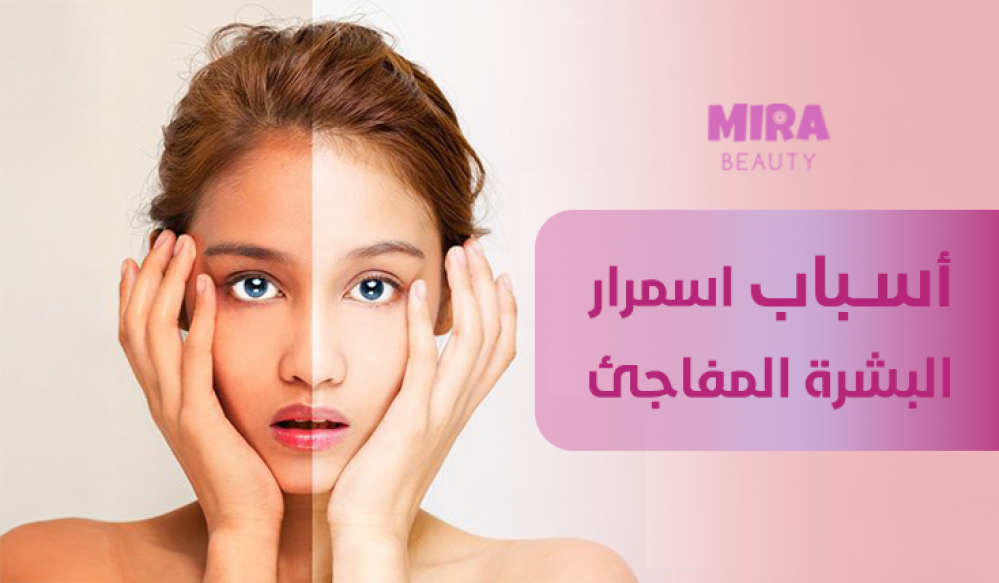 أسباب اسمرار البشرة المفاجئ: لماذا يتغير لون بشرتك وكيف تعالجينه؟