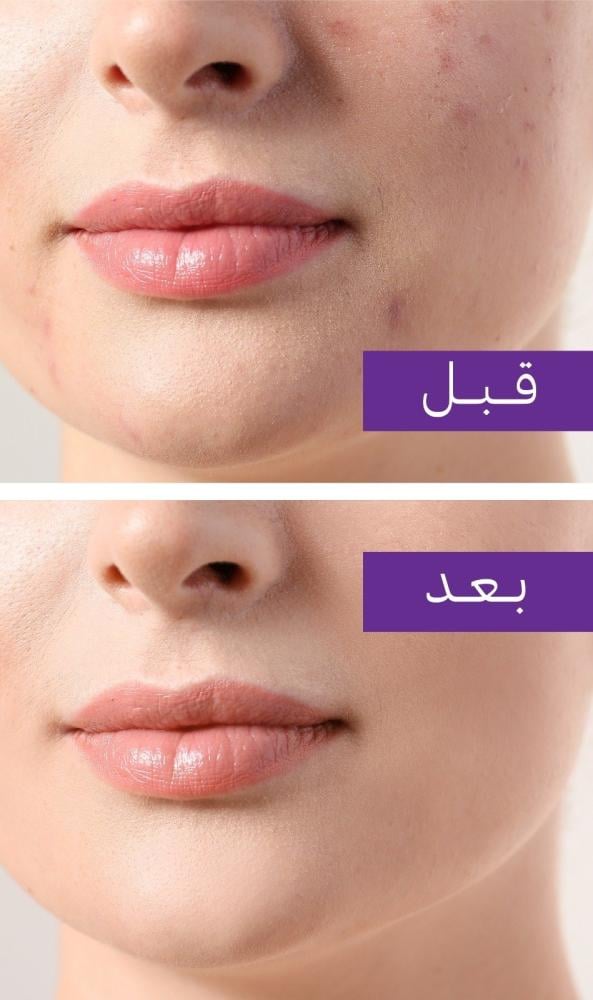 Los 5 mejores productos para una piel suave y luminosa en verano