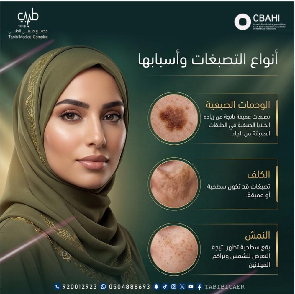 انواع التصبغات واسبابها