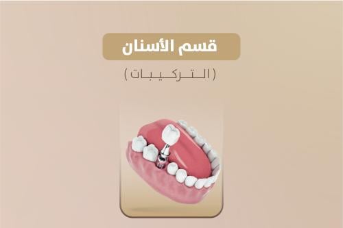 عدسة ( الفينير) 3D