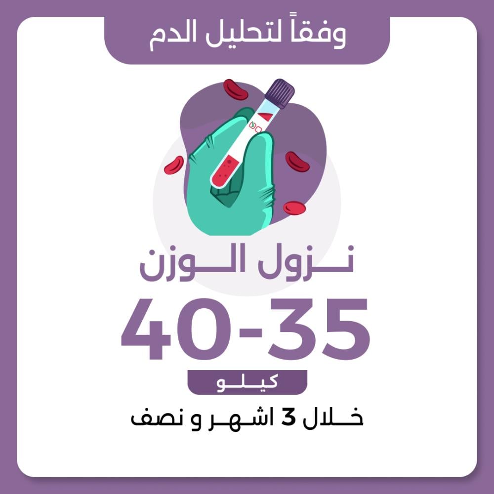 فقدان الوزن بشكل سريع