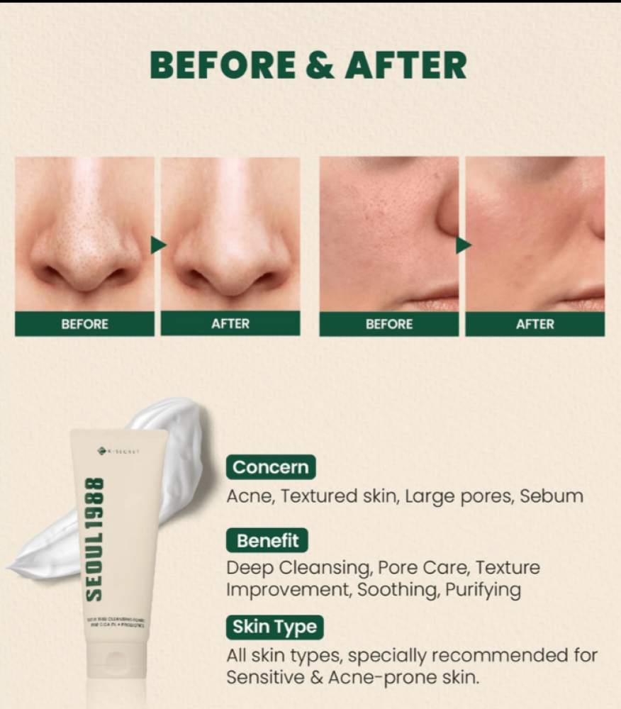 رغوة التنظيف كي سيكريت سيول 1988 برائحة الصنوبر والسيكا 1%+ بروبيوتيك 200 مل