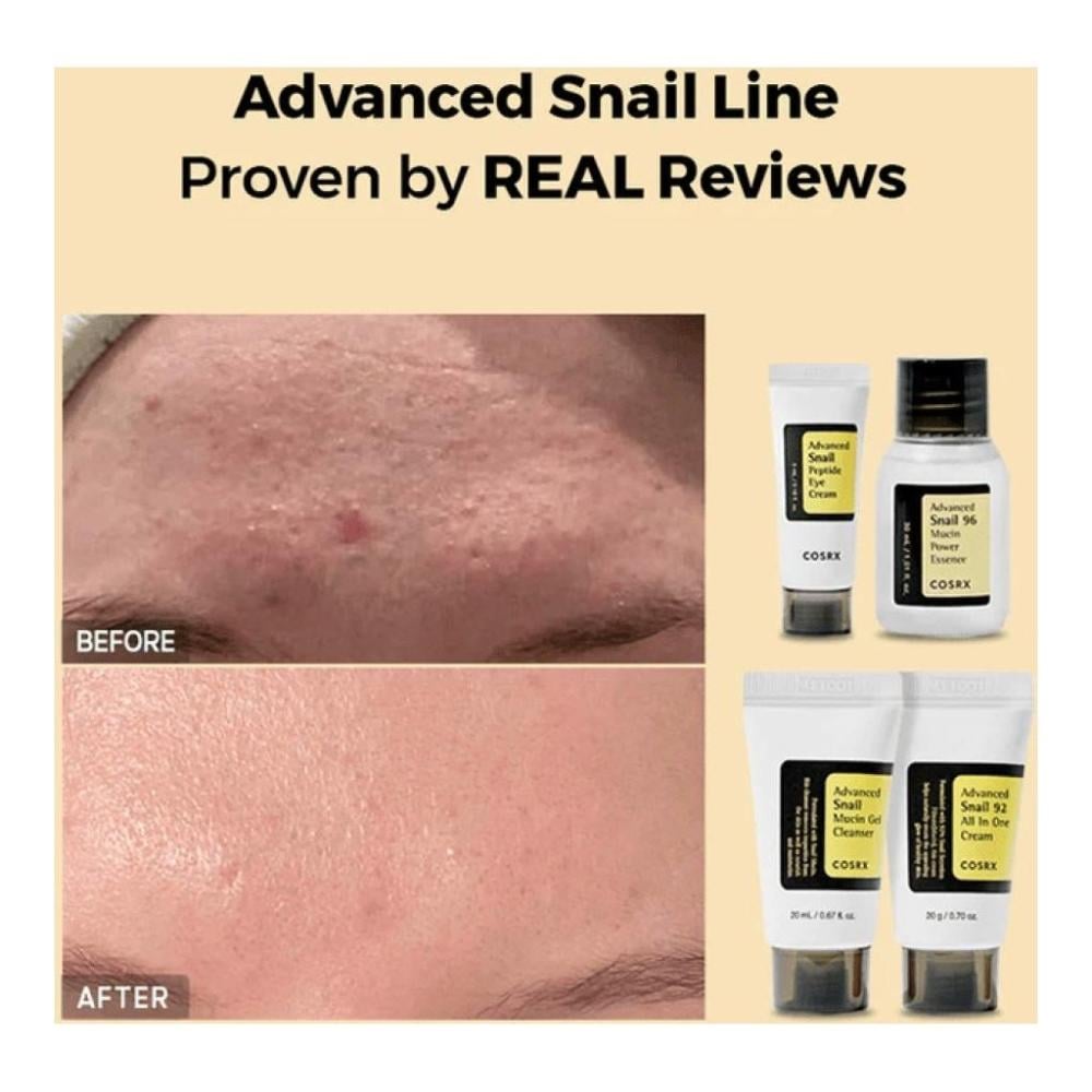 كوزريكس مجموعة الحلزون المكونة من 4 قطع