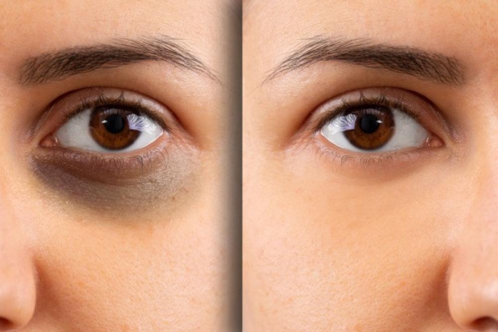 دليلك لاستخدام سيروم تحت العين