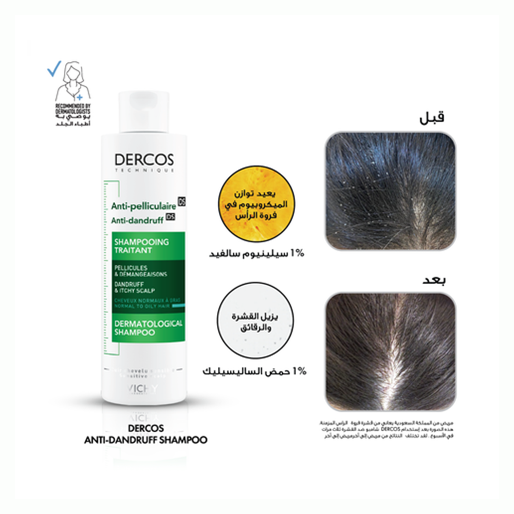 فيشي ديركوس شامبو مضاد للقشرة والشعور بالحكة للبشرة الحساسة 200مل