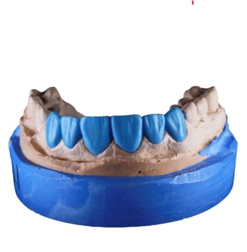 112 . تشميع بغرض التشخيص Diagnostic wax up