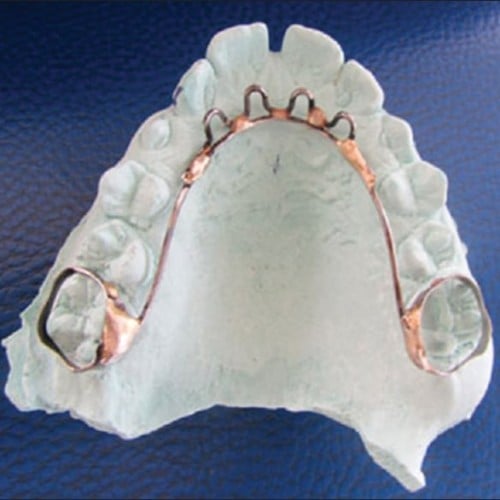 305 جهاز صاد لساني للفك العلوي Palatal Crib