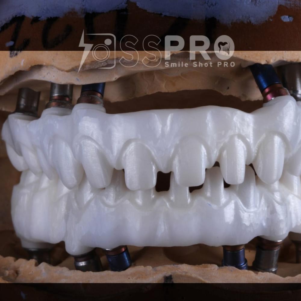 220 . هيكل زركون للزراعة مع خزف لثة  Zircon implant frame with pink porcelain